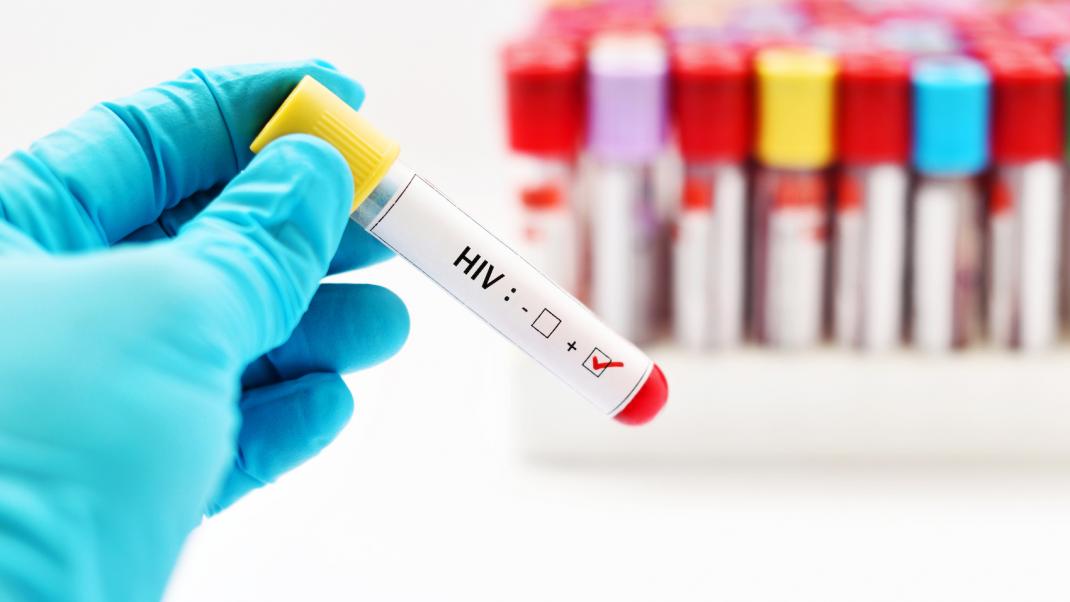 hiv